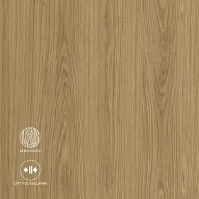 卡斯托莫A658 Klimt饰面